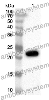 Anti-PARK7 Polyclonal Antibody