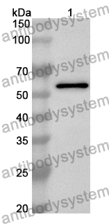 Anti-SORT1 Polyclonal Antibody