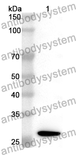 Anti-PLIN2 Polyclonal Antibody