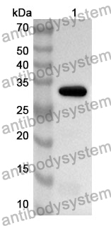 Anti-P2RX7 Polyclonal Antibody