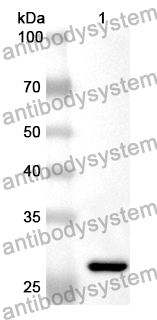 Anti-SCAF11 Polyclonal Antibody