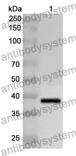 Anti-OSMR Polyclonal Antibody