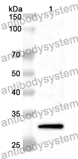 Anti-MAP3K5 Polyclonal Antibody