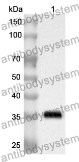 Anti-MGLL Polyclonal Antibody