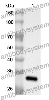 Anti-SMAD5 Polyclonal Antibody