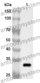 Anti-SEPTIN5 Polyclonal Antibody