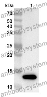 Anti-SLC30A3 Polyclonal Antibody