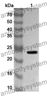 Anti-TIMP4 Polyclonal Antibody