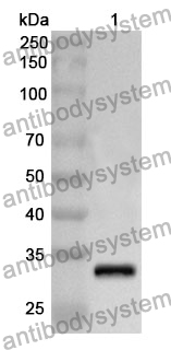 Anti-APBA2 Polyclonal Antibody