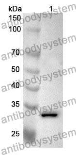 Anti-OLFM1 Polyclonal Antibody