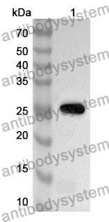 Anti-GPA33 Polyclonal Antibody