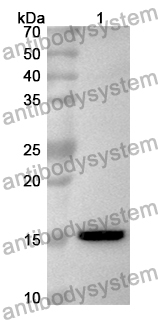 Anti-HIF2A/EPAS1 Polyclonal Antibody