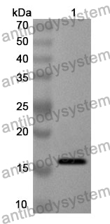 Anti-RARRES2 Polyclonal Antibody