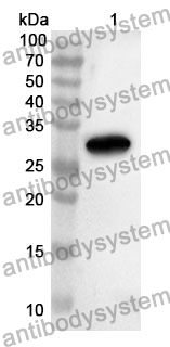 Anti-MYOC Polyclonal Antibody