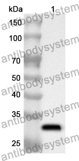 Anti-TEP1 Polyclonal Antibody