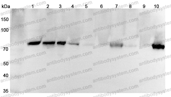 Anti-SEMA3C Polyclonal Antibody