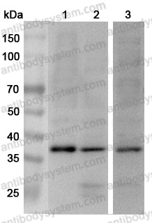 Anti-Human APOL2 Polyclonal Antibody