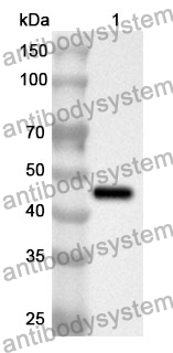 Anti-ACAT2 Polyclonal Antibody