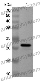 Anti-CD290/TLR10 Polyclonal Antibody