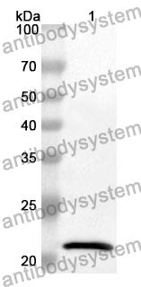 Anti-ITPA Polyclonal Antibody