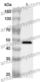 Anti-HDAC8 Polyclonal Antibody