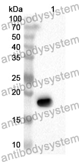 Anti-MRPL1 Polyclonal Antibody