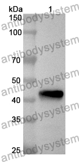 Anti-ACE2 Polyclonal Antibody