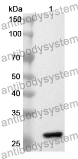 Anti-MDA5/IFIH1 Polyclonal Antibody