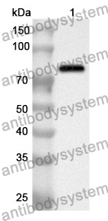 Anti-Human MDA5/IFIH1 Polyclonal Antibody