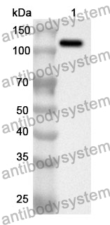 Anti-Human MDA5/IFIH1 Polyclonal Antibody