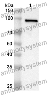 Anti-Human MDA5/IFIH1 Polyclonal Antibody