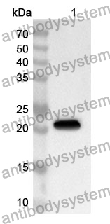 Anti-UACA Polyclonal Antibody