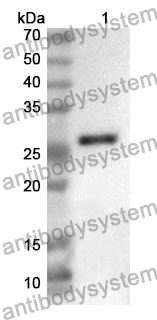 Anti-PRKD2 Polyclonal Antibody