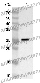 Anti-Human CD169/SIGLEC1 Polyclonal Antibody