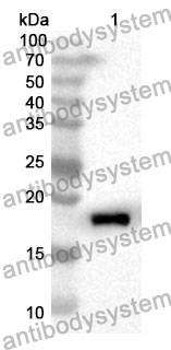 Anti-KRT23 Polyclonal Antibody