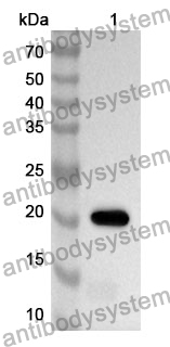 Anti-AICDA Polyclonal Antibody