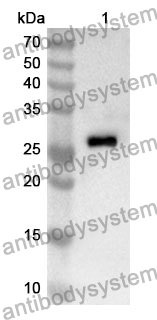 Anti-TOLLIP Polyclonal Antibody