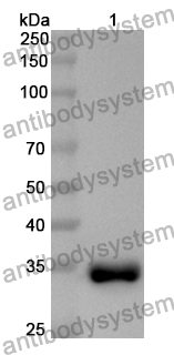 Anti-NT5C3A Polyclonal Antibody