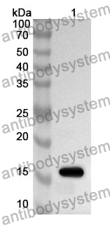 Anti-RNASE7 Polyclonal Antibody