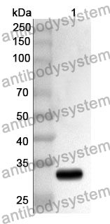 Anti-MYLK2 Polyclonal Antibody