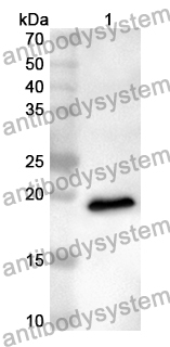 Anti-Human IL25/IL17E Polyclonal Antibody