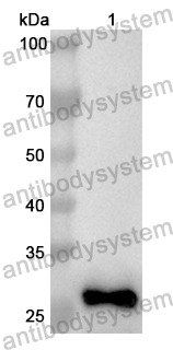 Anti-TNKS2 Polyclonal Antibody