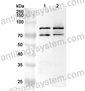 Anti-Human FOXP1 Polyclonal Antibody