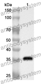 Anti-TP63 Polyclonal Antibody