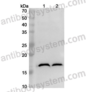 Anti-MAP1LC3A Polyclonal Antibody