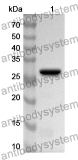 Anti-RNPEP Polyclonal Antibody