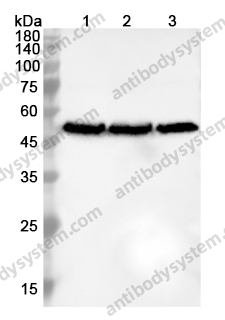 Anti-TUBB1 Polyclonal Antibody