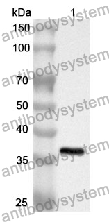 Anti-BCAS3 Polyclonal Antibody