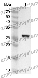 Anti-PTGES2 Polyclonal Antibody