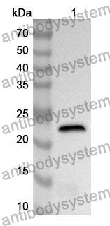 Anti-ECT2 Polyclonal Antibody